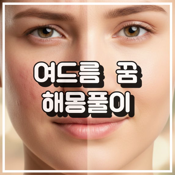 여드름 꿈 해몽, 불안과 컴플렉스의 상징 꿈해석 썸네일